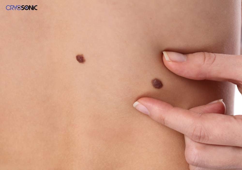 Infection Risk and Poor Aftercare Doncaster